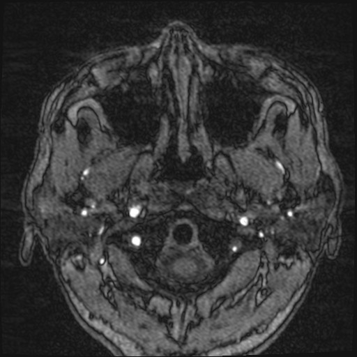 Click on the Serie image to view the images of VILLANUEVA, WILLIAM A.